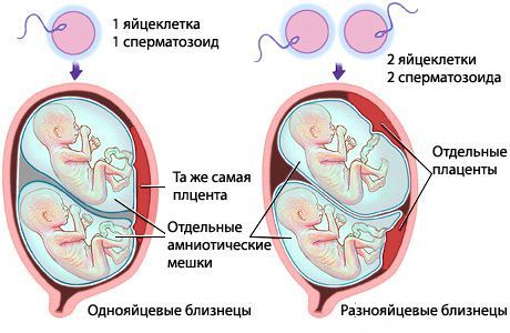 Перші ознаки вагітності двійнятами