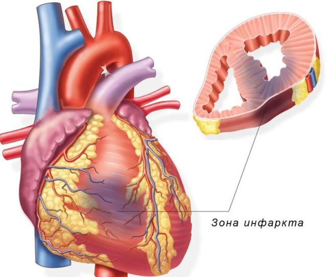 Відрижка - причини відрижки після їжі, відрижки тухлими яйцями, відрижки повітрям