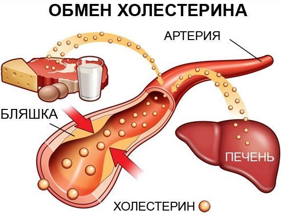 Атеросклероз: симптоми, причини, способи діагностики та профілактики, медикаментозні методи лАтеросклероз: симптоми, причини, способи діагностики та профілактики, медикаментозні методи лікування атеросклерозу і засоби народної медицини