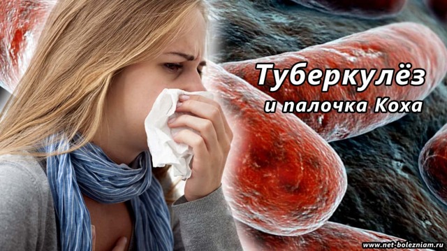 Симптоми, діагностика та лікування туберкульозу