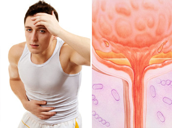 Цистит у чоловіків: симптоми і лікування в домашніх умовах, ліки від циститу