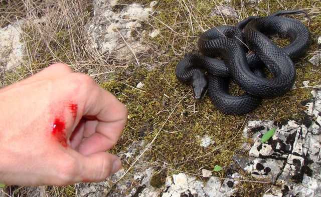 Перша допомога при укусі змії: що робити при укусі отруйної змії, вужа, кобри