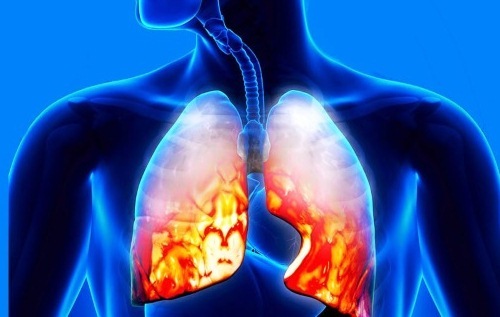 Показання до проведення УЗД бронхів і легенів