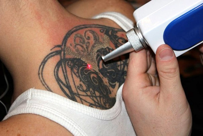 Татуювання: небезпека для здоров'я, ризики зараження інфекційними захворюваннями