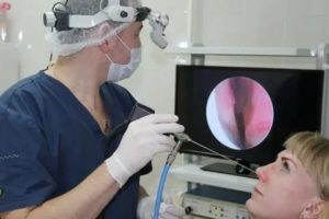 Ендоскопія носа: що показує дослідження ЛОР органів при огляді