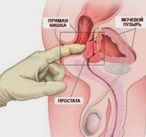 Відсутність бажання у чоловіків: причини і лікування, методики відновлення лібідо