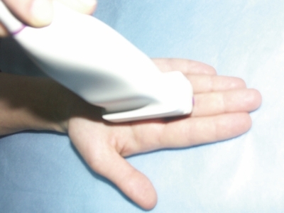Стенозуючий лігаментит, блокування великого пальця: лікування