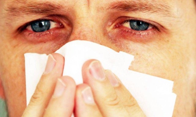 Алергічний кашель: причини і симптоми, методи лікування, як розпізнати