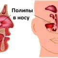 Рентген пазух носа: що показує, як часто можна робити, розшифровка