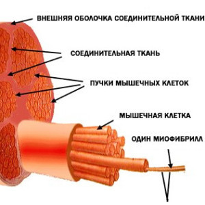 Як позбутися від болю в м'язах після тренування і чим може бути викликана біль