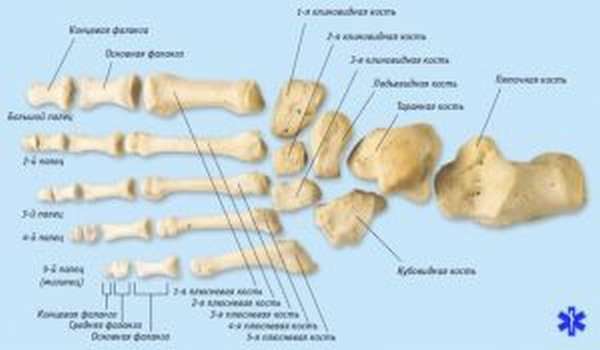 Перелом пальця на нозі: провокуючі фактори, характерні ознаки, перша допомога і тактика лікування