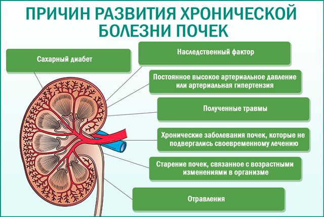 Хвороби нирок: симптоми, ознаки захворювань нирок, причини хронічних хвороб нирок