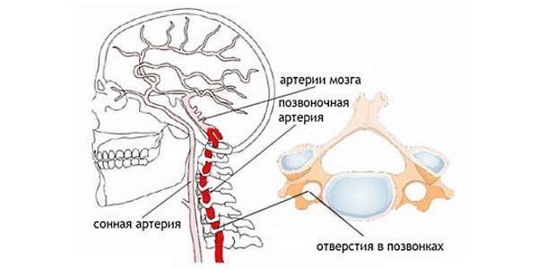 Шум, дзвін у вухах при остеохондрозі шийного відділу: лікування, причини, симптоми