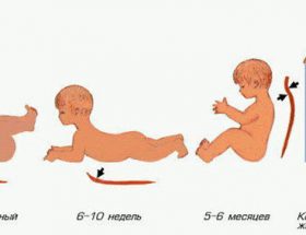 Лордоз у дитини: провокуючі фактори, клінічна картина, діагностика і способи лікування