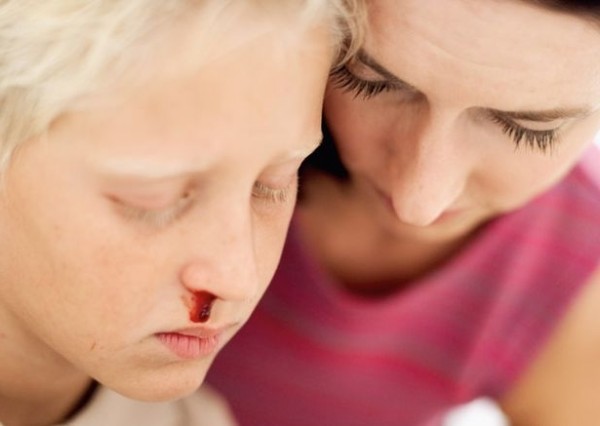 Геморагічні діатези у дітей: класифікація патології, супутні симптоми, діагностика та методи лікування