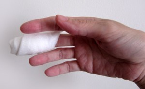 Вивих пальця на руці: що робити, симптоми вивиху великого пальця на руці, лікування