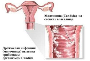 Клотримазол мазь: інструкція із застосування, клотримазол мазь при молочниці у жінок