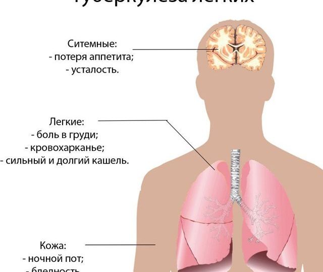 Туберкульоз печінки: основні ознаки, методи діагностики і лікування, прогнози лікарів