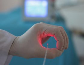 Видалення зовнішнього геморою - види операцій, лікування патології лазером