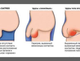 Прищі на мошонці: причини появи і методи лікування висипу на інтимному органі