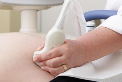 Ендометріоїдна кіста при вагітності: що потрібно робити?