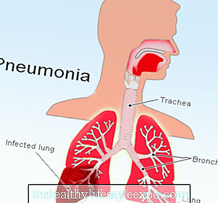 Пневмонія при раку легенів: діагностика, симптоми і лікування