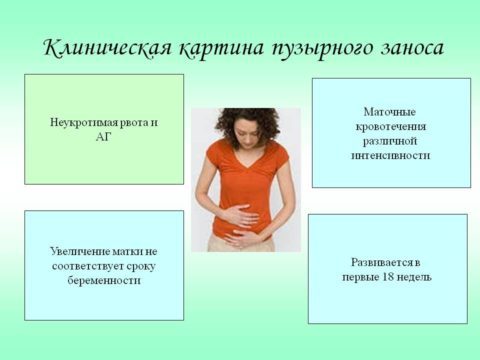 Гіпертиреоз при вагітності: симптоми, вплив на плід, лікування