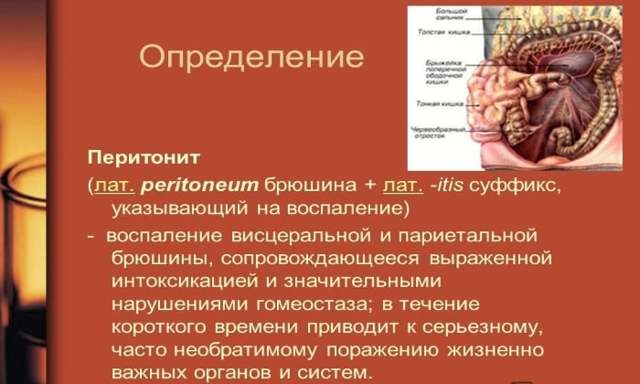 Жовчний перитоніт: клінічні форми, симптоми, лікування, наслідки