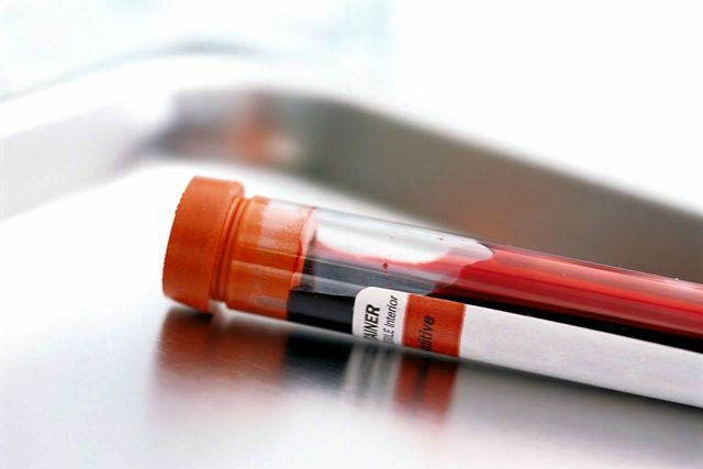 Сечовина в крові: норми, чому буває підвищена сечовина в крові: причини підвищення рівня сечової кислоти