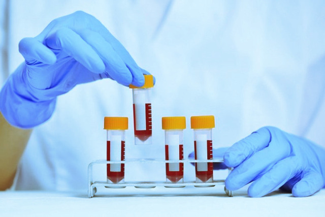 Аналізи крові на сифіліс: РИФ, ІФА, РВ, РІБТ, РПГА тест, ПЛР, розшифровка