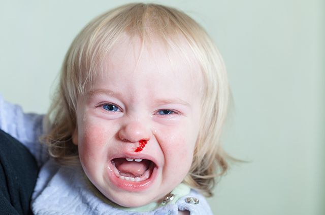 Соплі з кров'ю у дитини при нежиті: чому і що робити?