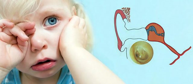 Серозний отит: діагностика та лікування у дітей та дорослих, профілактика