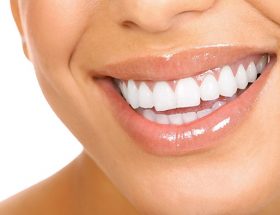 Професійне відбілювання зубів: види, показання, особливості проведення
