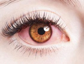 Болить куточок ока ближче до носа: причини і лікування