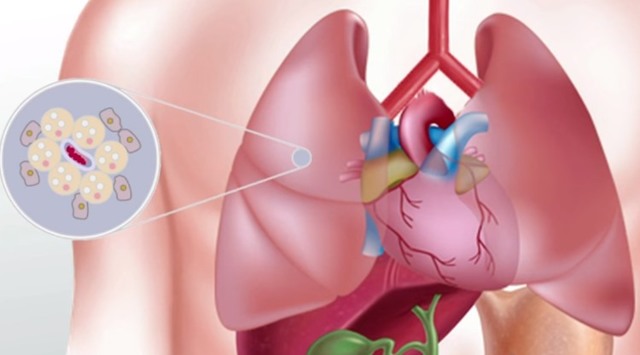 Туберкульоз печінки: симптоми і перші ознаки, як передається, діагностика і лікування