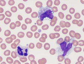 Чому моноцити підвищені у дитини, їх норма в крові у дітей