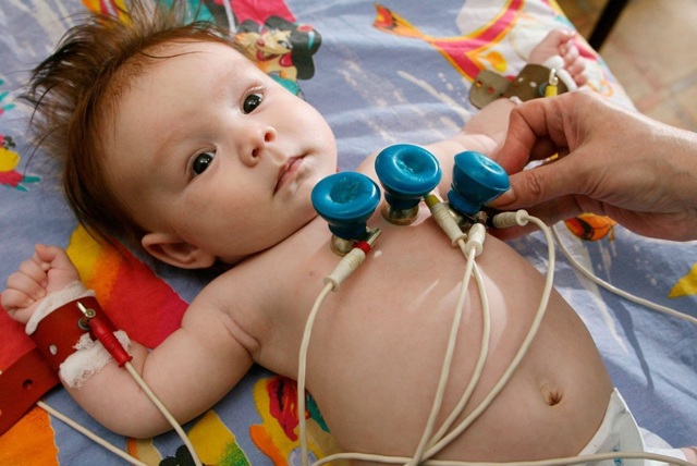 Причини шумів в серці у дитини (новонародженого і грудного)