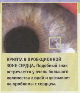 Іридодіагностика (схема райдужної оболонки ока): суть діагностики, карта рогівки