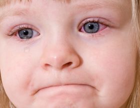 Червоні очі і соплі у дитини: причини і лікування