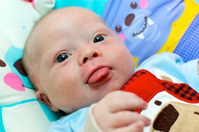 Синдром Дауна: причини, як визначити новонародженого з синдромом Дауна, патології дитини з синдромом Дауна