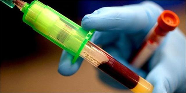Аналіз крові на вітаміни і мікроелементи: норми, розшифровка, як називається