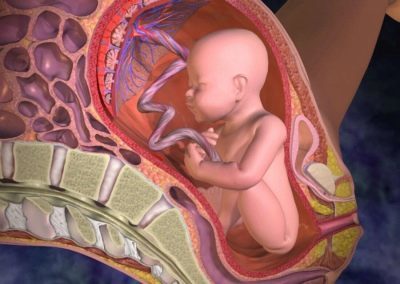 Відшарування плаценти на ранніх і пізніх термінах вагітності: фактори ризику, супутні симптоми, лікарські дії і можливі наслідки
