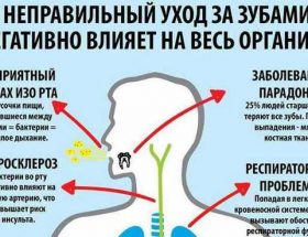 Професійне чищення зубів: види, показання, особливості проведення гігієнічної процедури в домашніх умовах