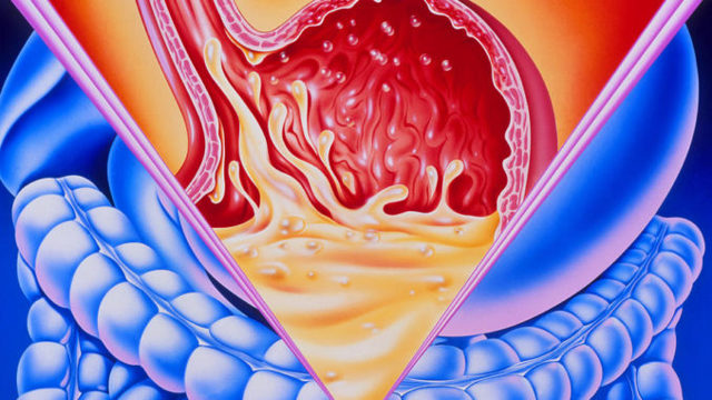 Слиз в шлунку: причини і лікування, ознаки, як діагностувати, дієта