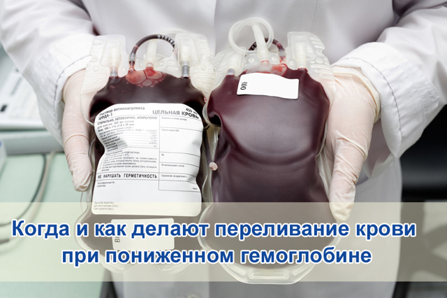 Переливання крові при низькому гемоглобіні: навіщо і як його роблять?