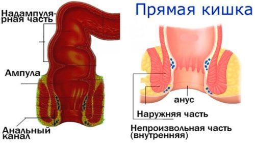 Ректальний пролапс: симптоми і лікування при випаданні прямої кишки у людини