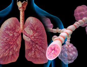 Свідчить сухий кашель про загострення бронхіальної астми?