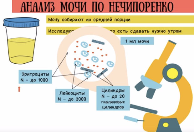 Аналіз сечі по Нечипоренко: як збирати, що показує, норми у жінок, дітей і чоловіків