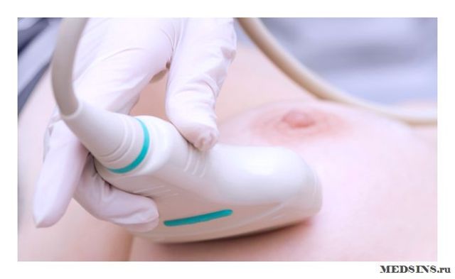 Обстеження молочних залоз: методи обстеження грудей, УЗД молочних залоз, мамографія