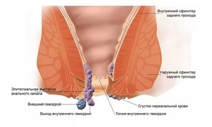 Мазь Флемінга: інструкція із застосування в ніс від нежиті і при гаймориті